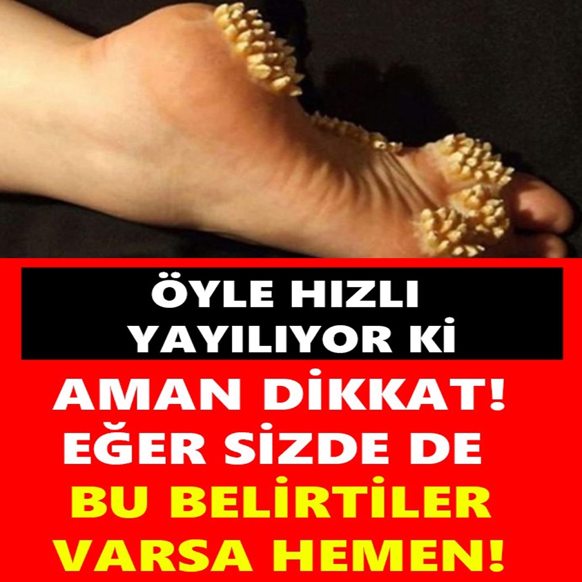 AMAN DİKKAT EĞER SİZDE DE BU BELİRTİLER VARSA HEMEN!