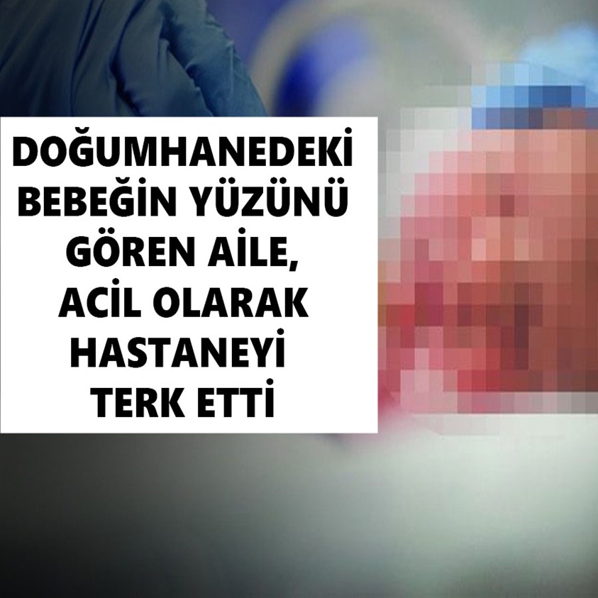 DOĞUMHANEDEKİ BEBEĞİN YÜZÜNÜ GÖREN AİLE ACİL OLARAK HASTANEYİ TERK ETTİ