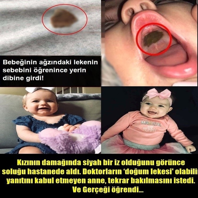 GENÇ ANNE BEBEĞİNİN AĞZINDAKİ LEKENİN SEBEBİNİ ÖĞRENİNCE ŞAŞKINA DÖNDÜ