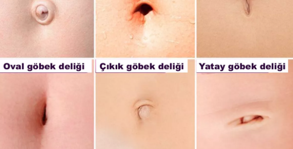 GÖBEK DELİĞİNİZ ÇOK ŞEY SÖYLÜYOR