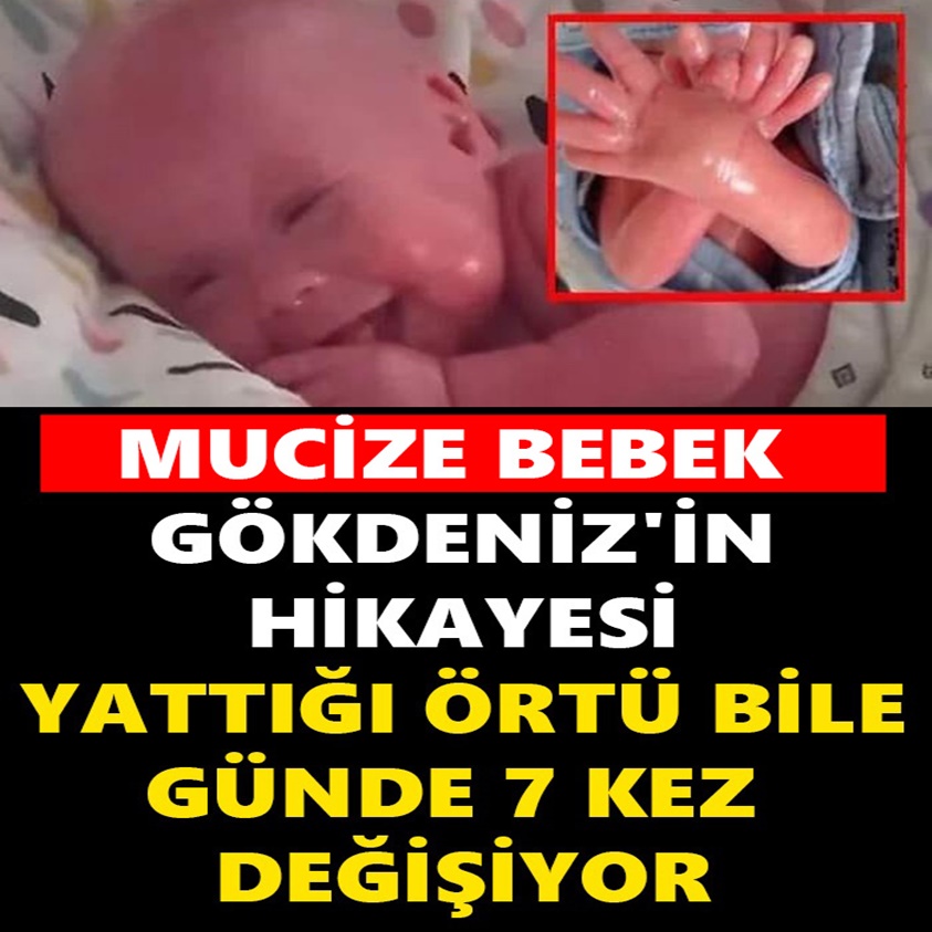 GÖKDENİZ'İN HİKAYESİ YATTIĞI ÖRTÜ BİLE GÜNDE 7 KEZ DEĞİŞİYOR