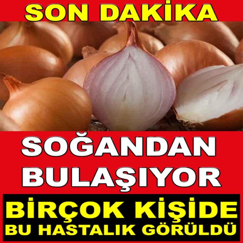 SOĞANDAN BULAŞIYOR BİRÇOK KİŞİDE BU HASTALIK GÖRÜLDÜ