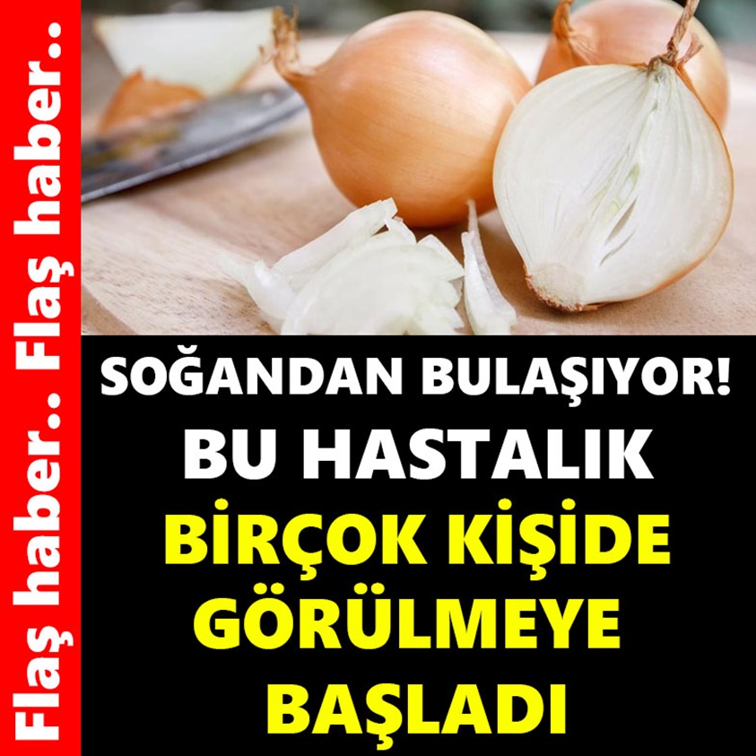 SOĞANDAN BULAŞIYOR BU HASTALIK BİRÇOK KİŞİDE GÖRÜLMEYE BAŞLADI