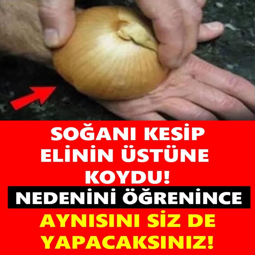 SOĞANI KESİP ELİNİN ÜSTÜNE KOYDU!