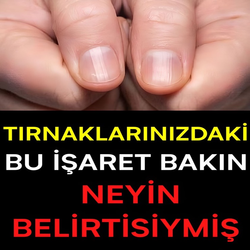 TIRNAKLARINIZDAKİ BU İŞARET BAKIN NEYİN BELİRTİSİYMİŞ