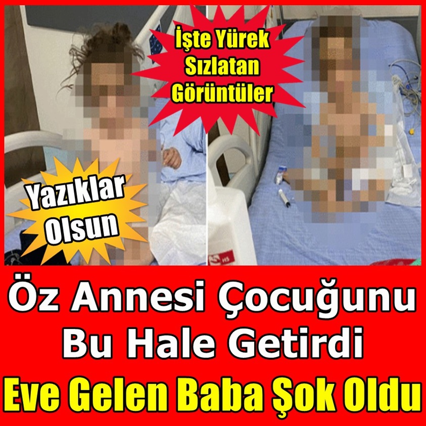 YAZIKLAR OLSUN ÖZ ANNESİ ÇOCUĞUNU BU HALE GETİRDİ 