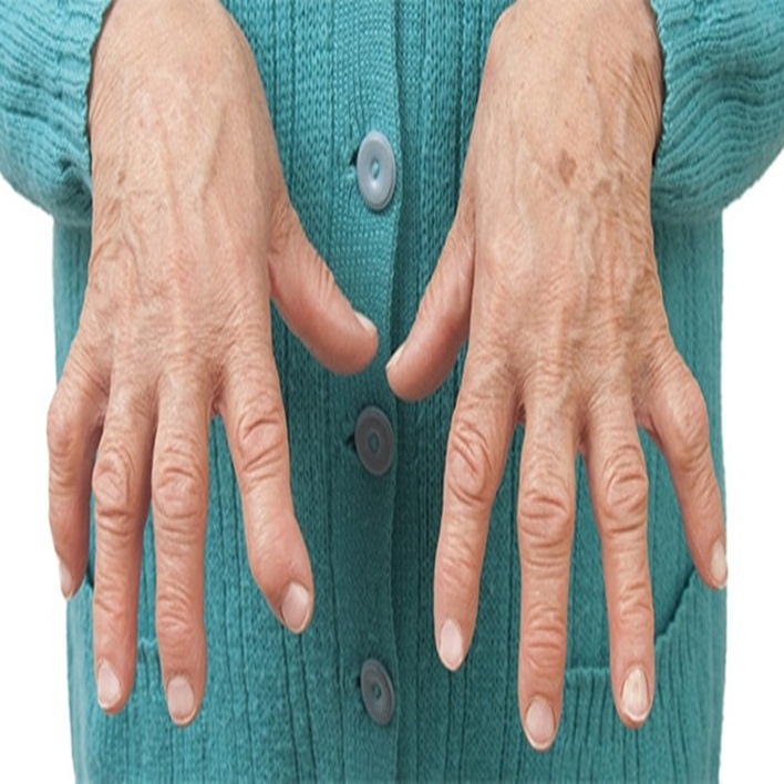 artrit-agrisi-nasil-olur