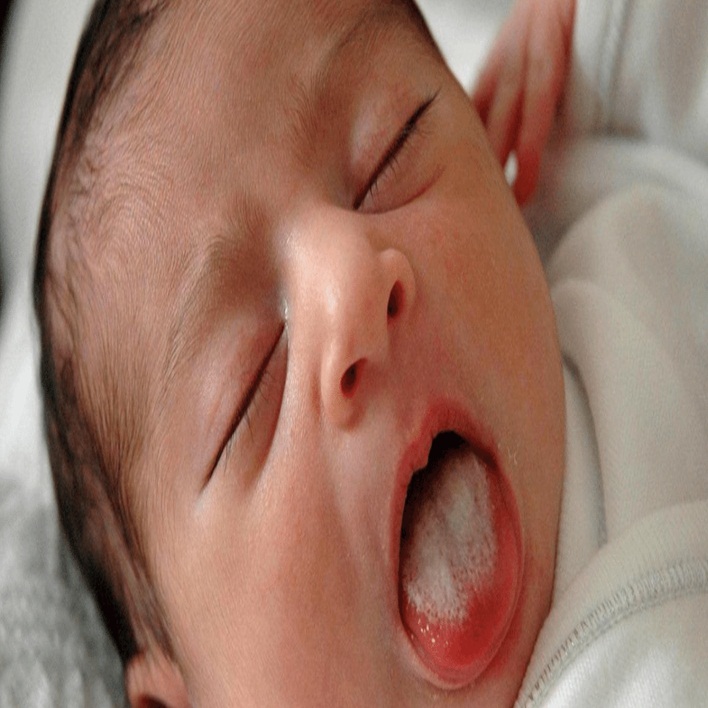 bebeklerde pamukcuk belirtileri nelerdir kadin hastaliklari