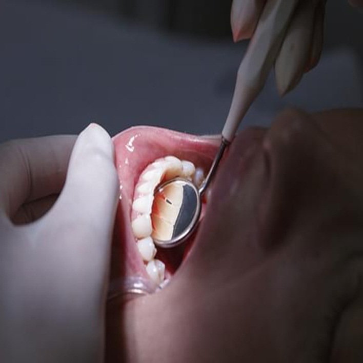 Diş Eti Çekilmesi Mi? Kadın Hastalıkları
