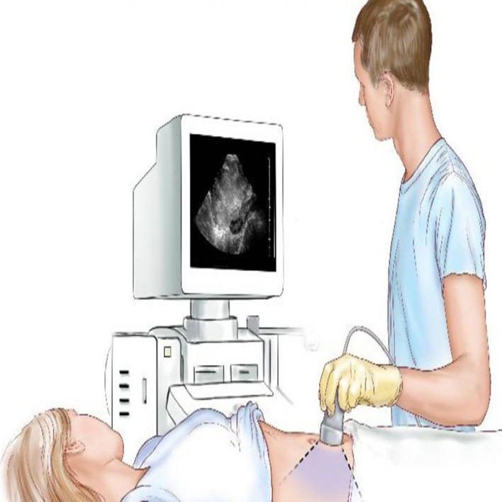 doopler-ultrasonografi-nasil-yapilir