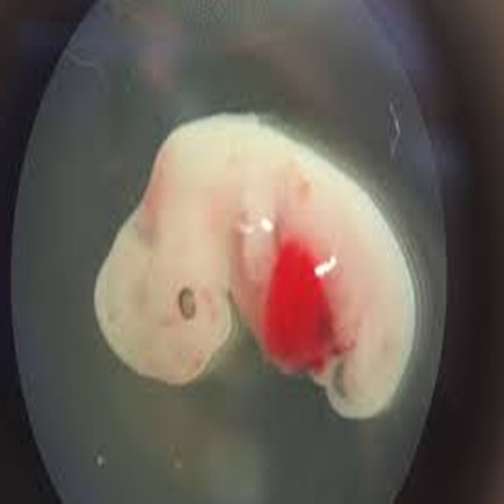 embriyo-asamalari