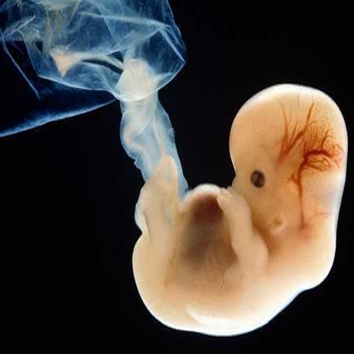 embriyo-transferi-sonrasi-seffaf-akinti