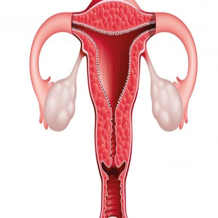 endometrial-polip-ameliyati