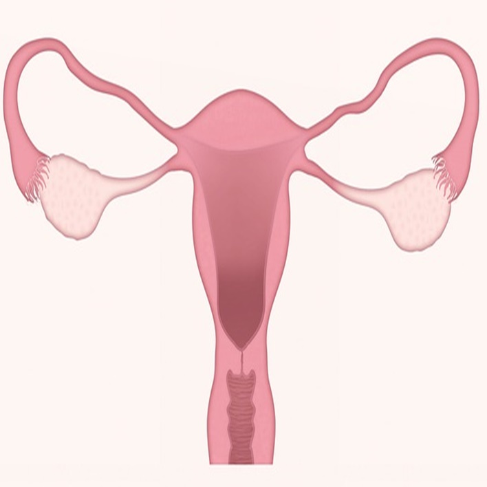 endometrial-polip-gebelige-engel-mi