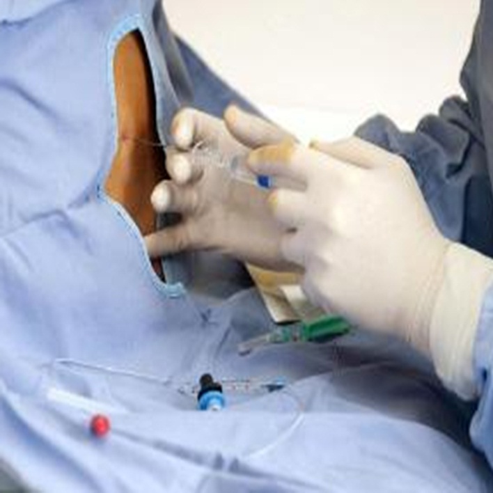 epidural-anestezi-fiyatlari-2020