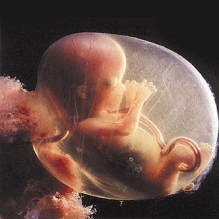 fetus-olumu-nasil-anlasilir