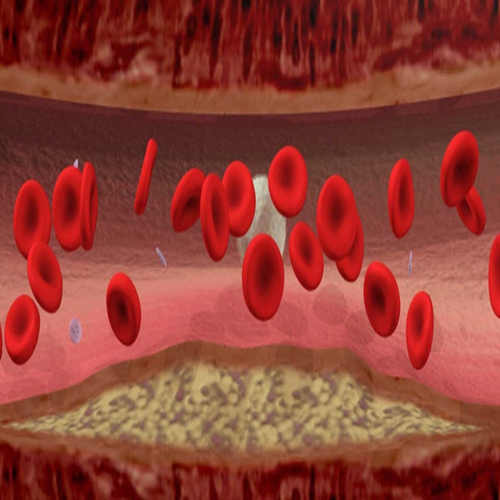 hemofili-belirtileri-nelerdir