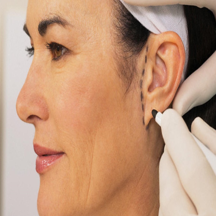 Kulak Estetiği Kaç Günde İyileşir? Kadın Hastalıkları