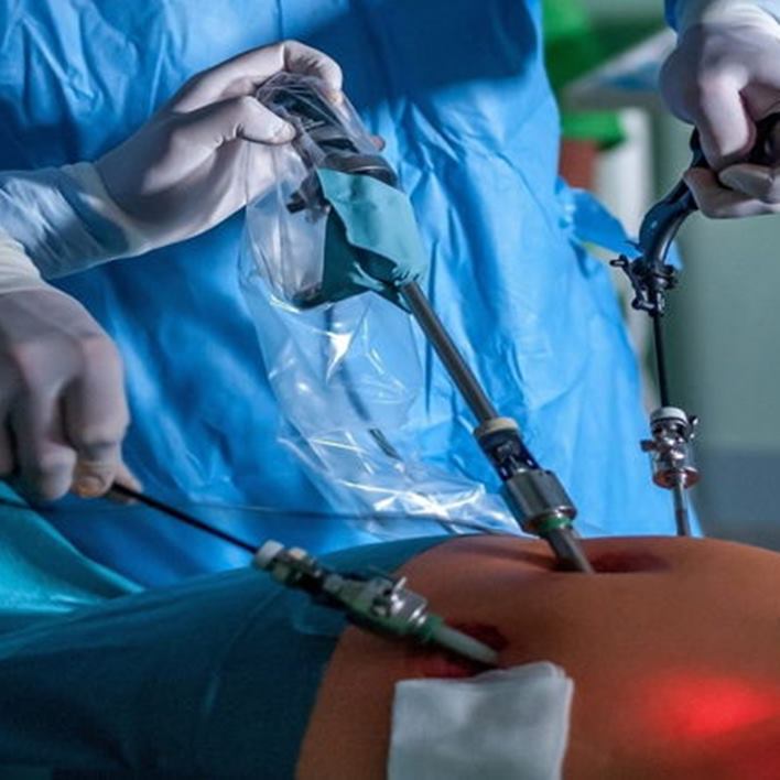 laparoskopi-dis-gebelik-ameliyati