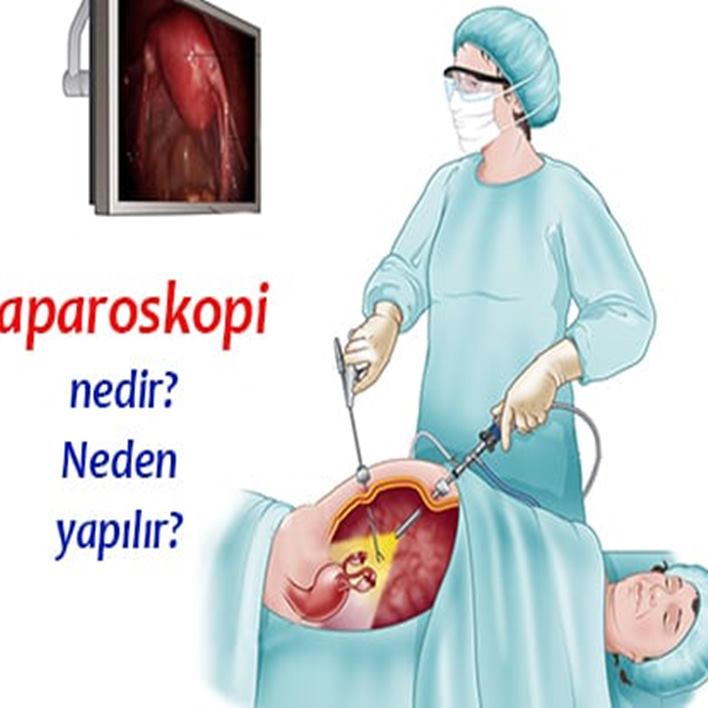 laparoskopi-i-zi-nasil-gecer