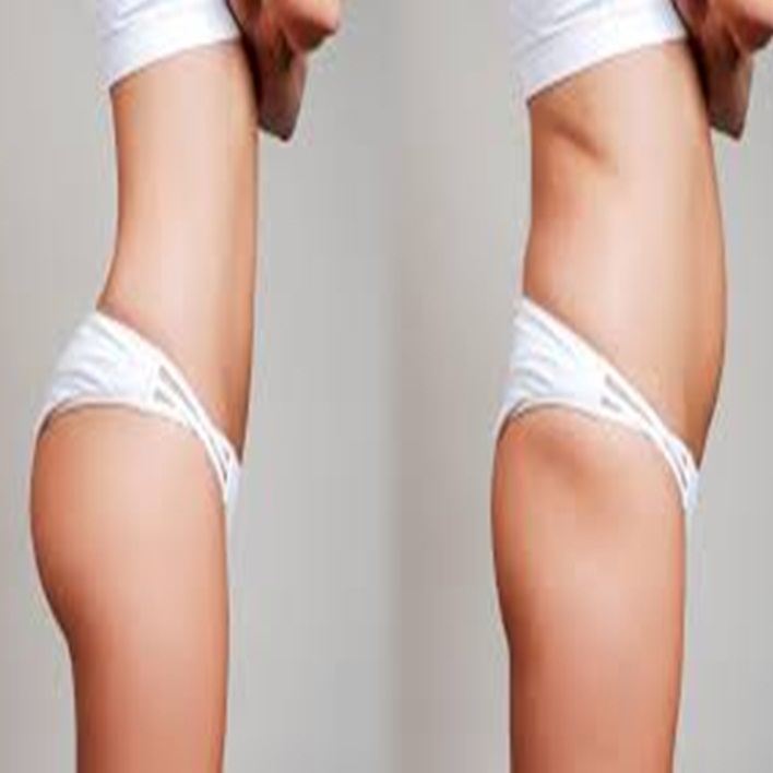 liposuction-zararlari
