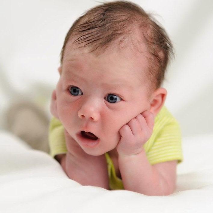 premature-bebeklerde-hidrosefali