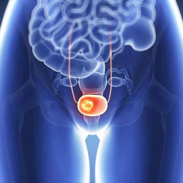 prostat-kanseri-hangi-organlara-sicrar