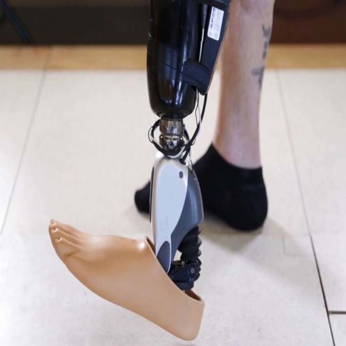 protez-bacak-nedir