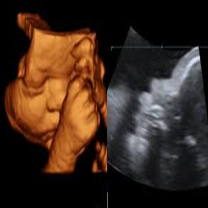 ultrasonografi-bebege-zarar-verir-mi