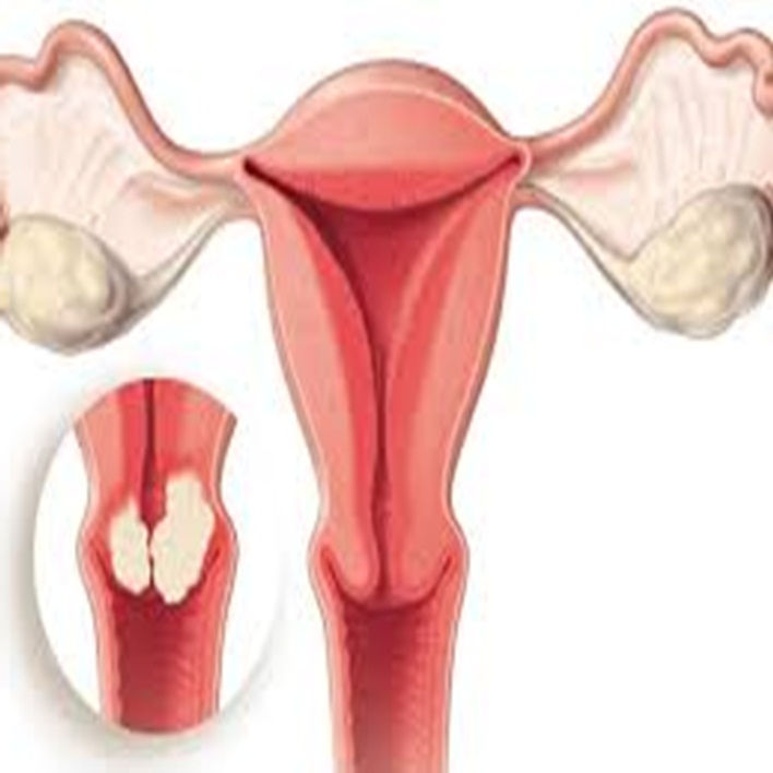 uterus-boyutlari