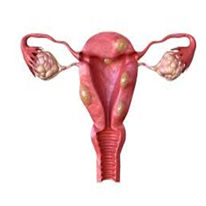 uterus-fundusu-nedir