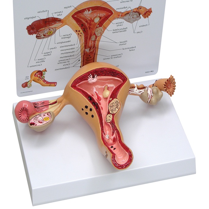 uterus-nedir